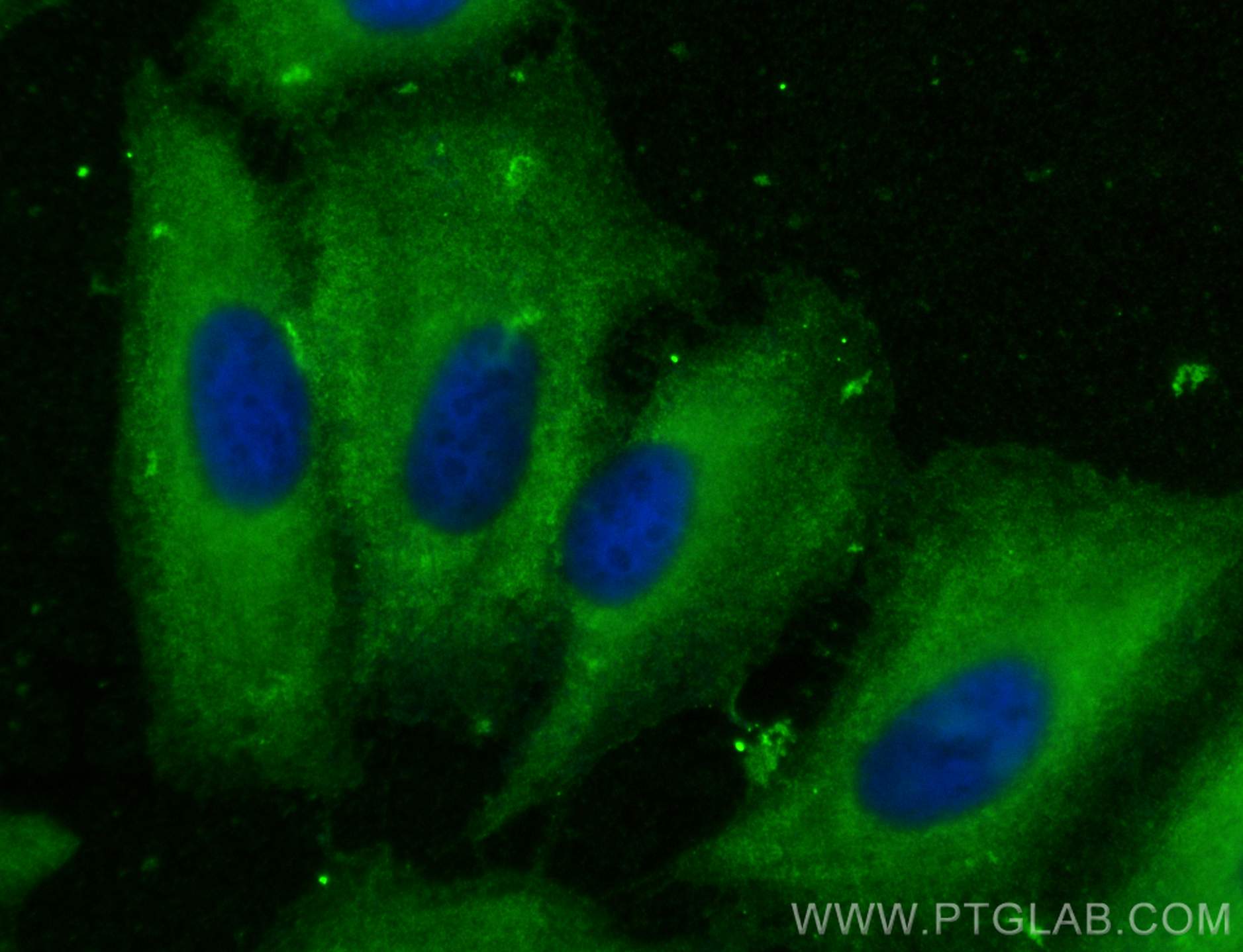 IF Staining of A549 using 21405-1-AP