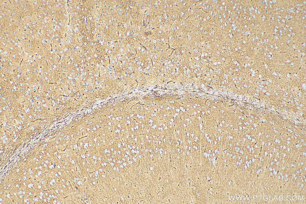 IHC staining of mouse brain using 68448-1-Ig (same clone as 68448-1-PBS)