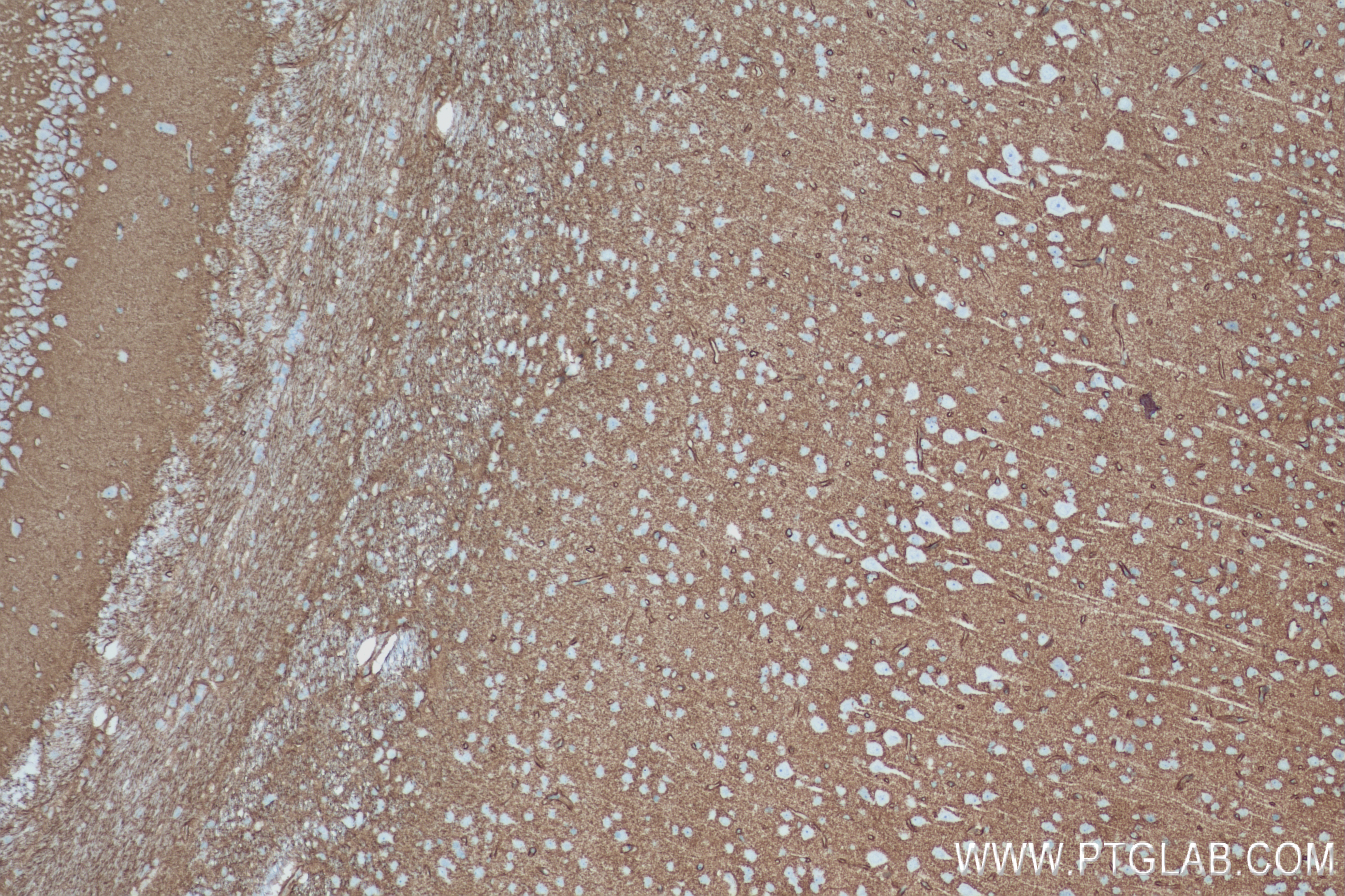 IHC staining of rat brain using 82296-6-RR