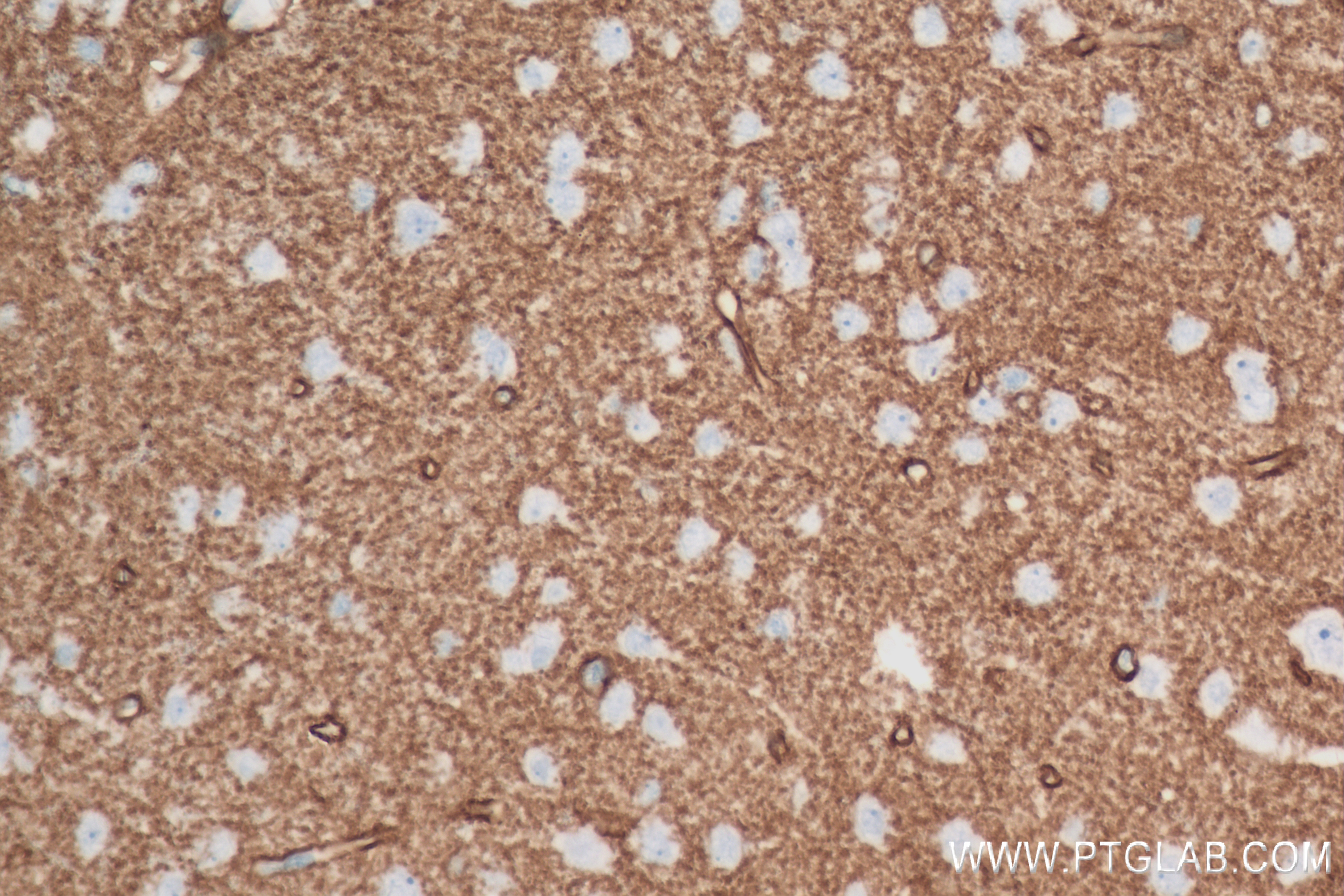 IHC staining of rat brain using 82296-6-RR