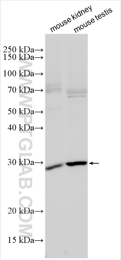 WB analysis using 25131-1-AP