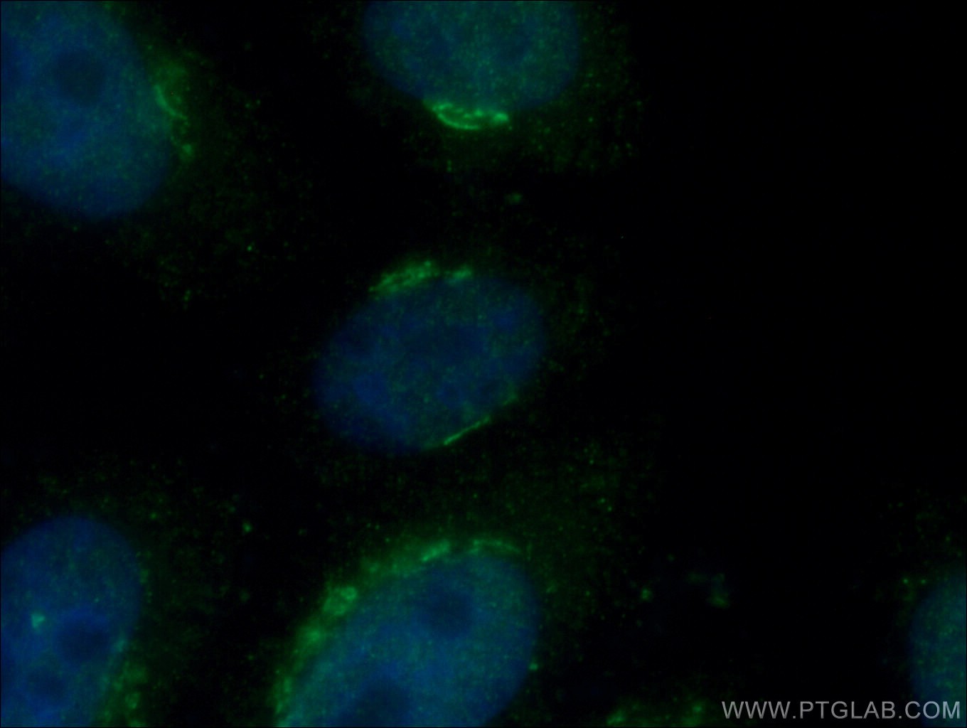 IF Staining of HepG2 using 20226-1-AP