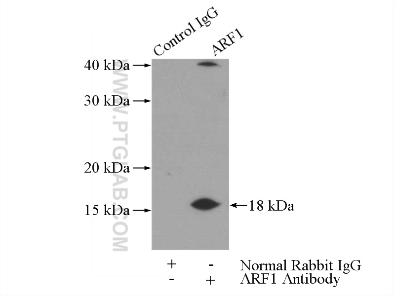 IP experiment of HeLa using 20226-1-AP