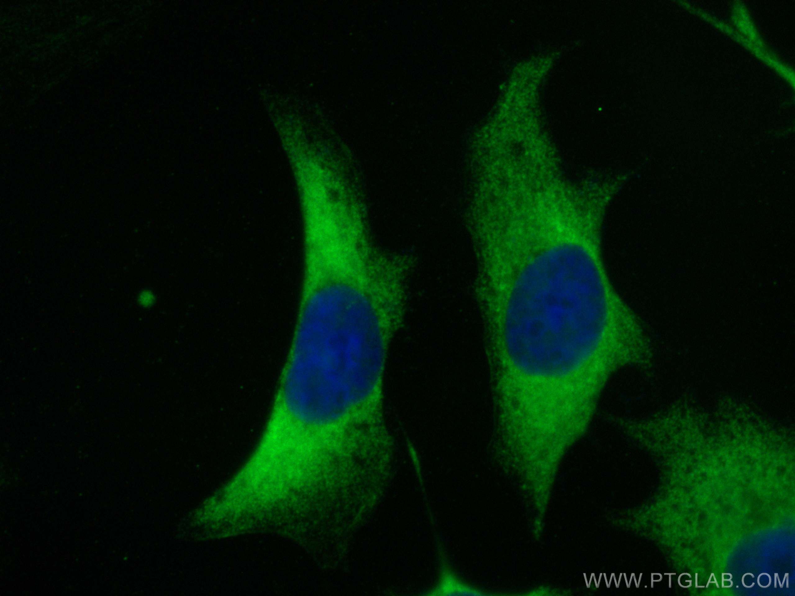 IF Staining of HeLa using 22289-1-AP