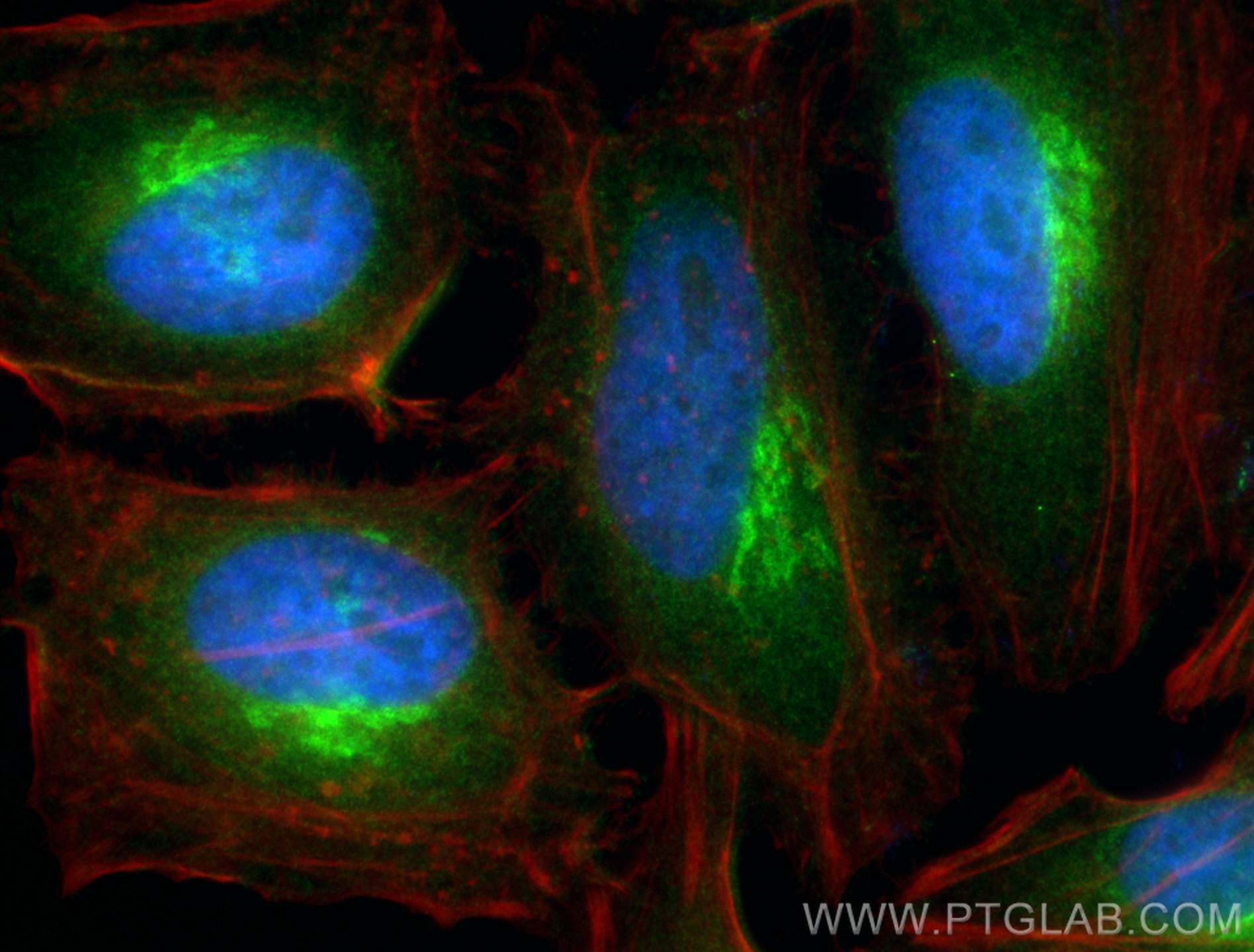 IF Staining of HeLa using 11673-1-AP