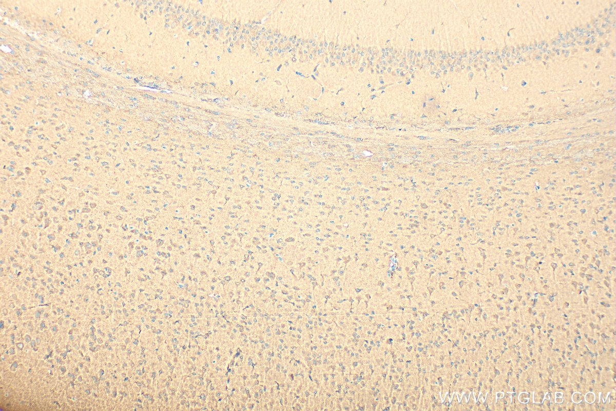 IHC staining of mouse brain using 11673-1-AP