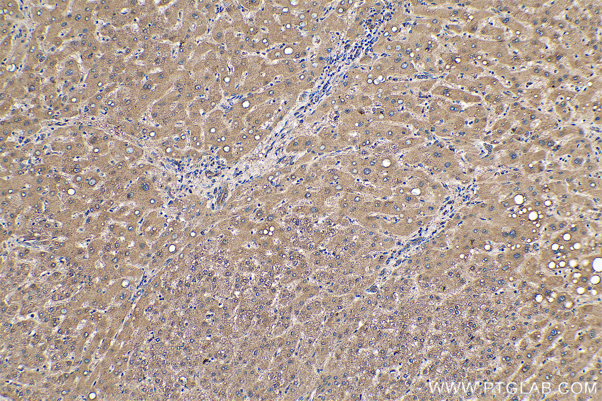 IHC staining of human liver using 68204-1-Ig (same clone as 68204-1-PBS)