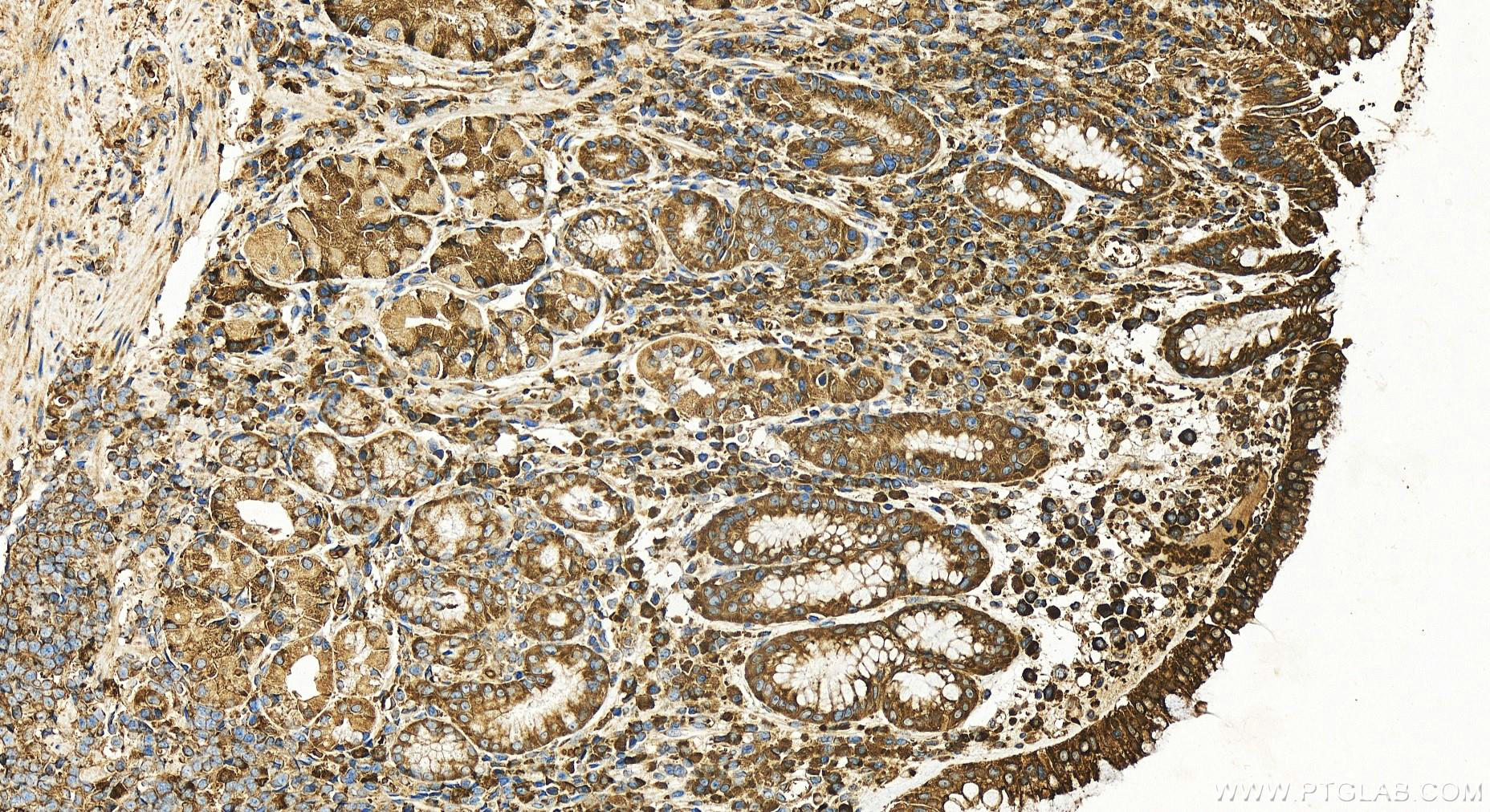 IHC staining of human stomach using 20227-1-AP