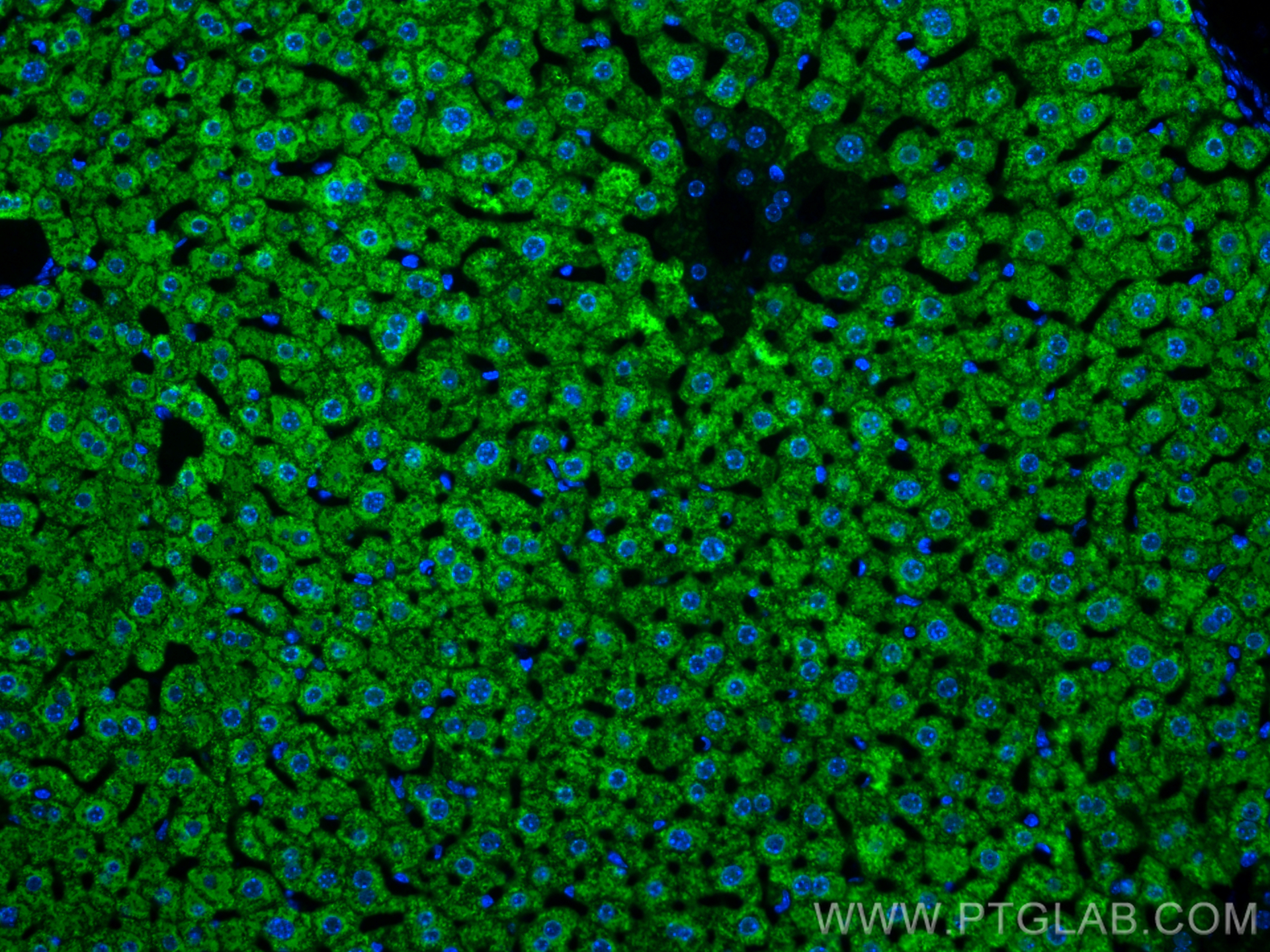 IF Staining of mouse liver using 16001-1-AP