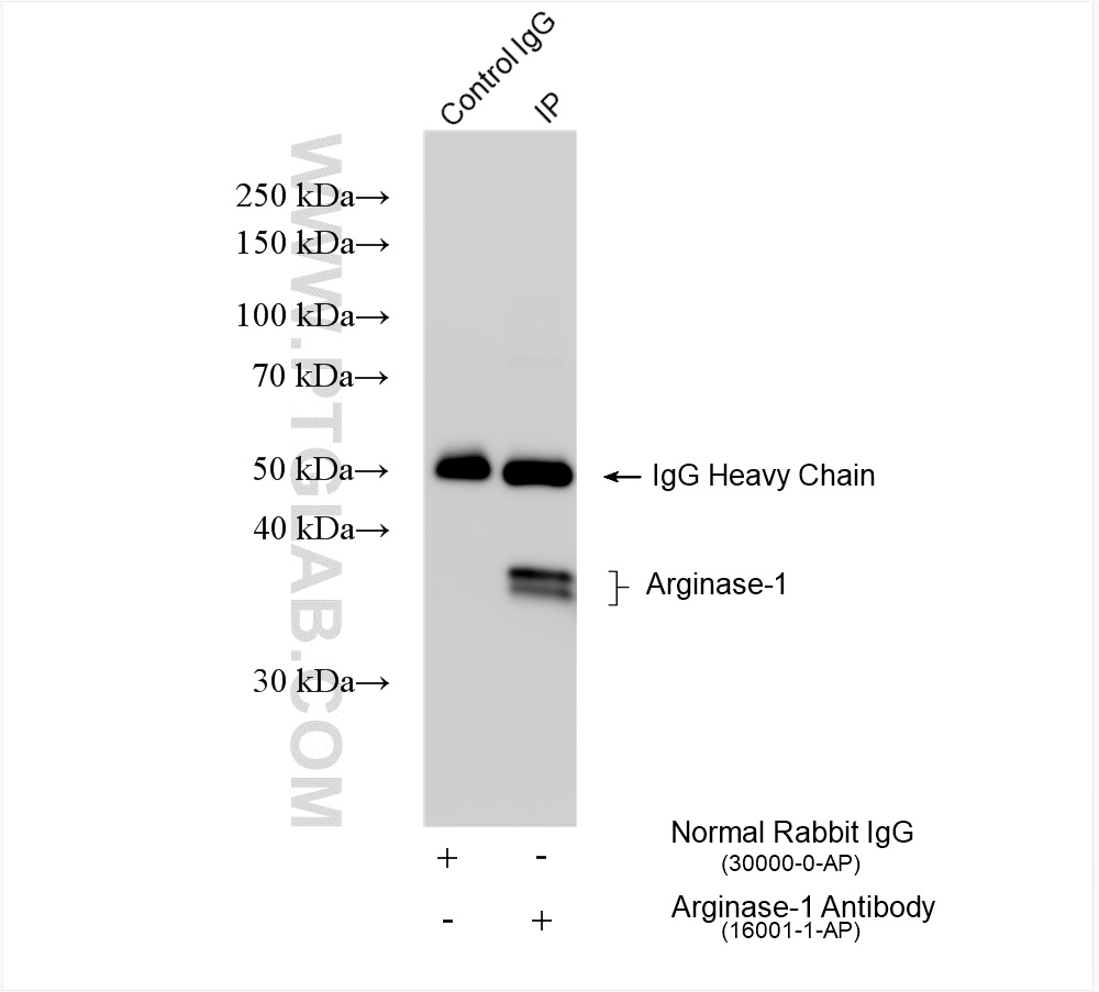 IP experiment of mouse liver using 16001-1-AP