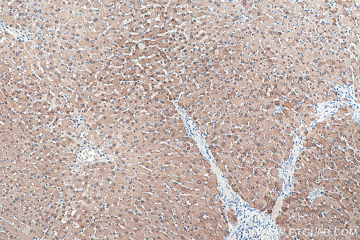 IHC staining of human liver using 66129-1-Ig