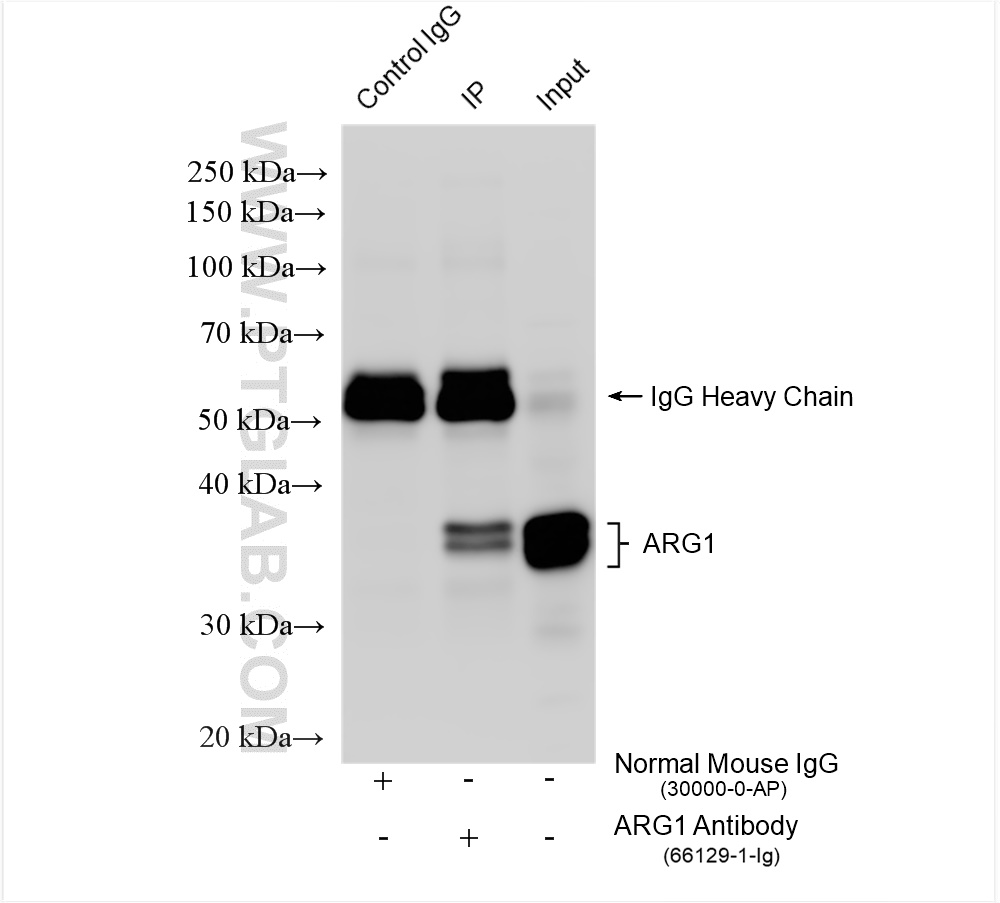 IP experiment of mouse liver using 66129-1-Ig (same clone as 66129-1-PBS)