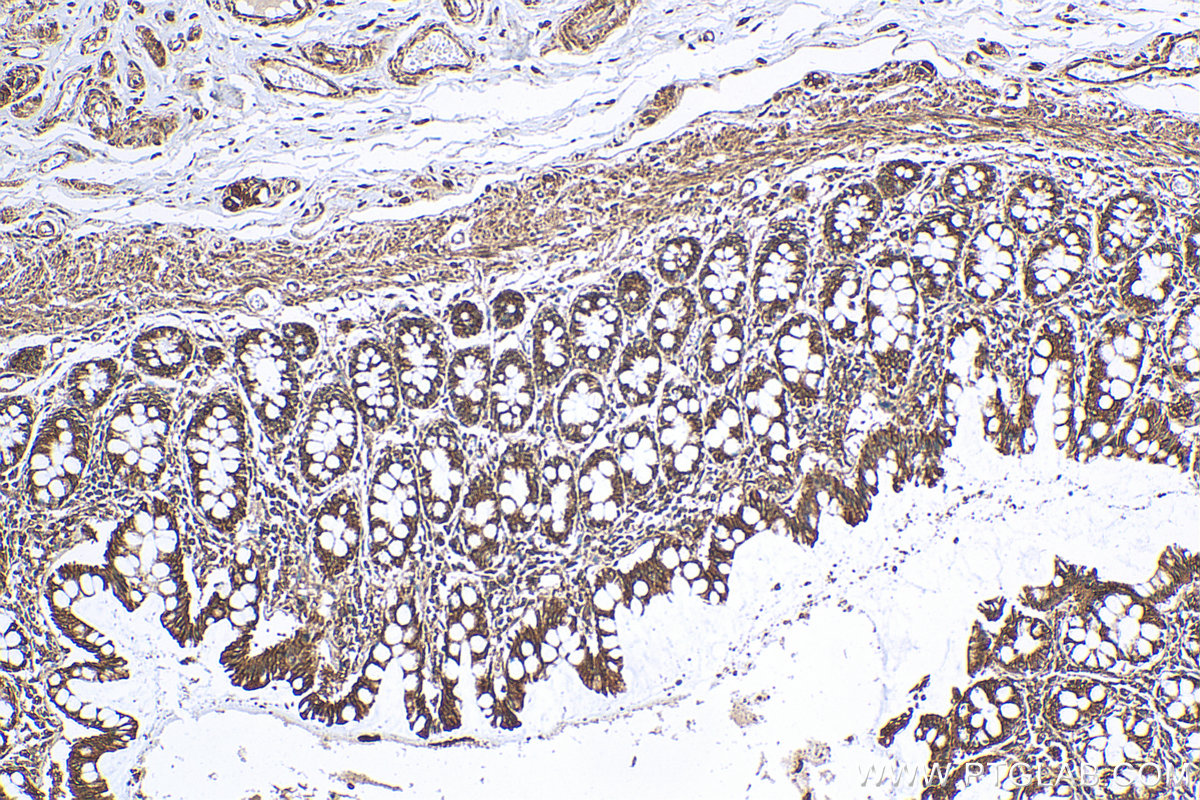 IHC staining of human colon using 11940-1-AP