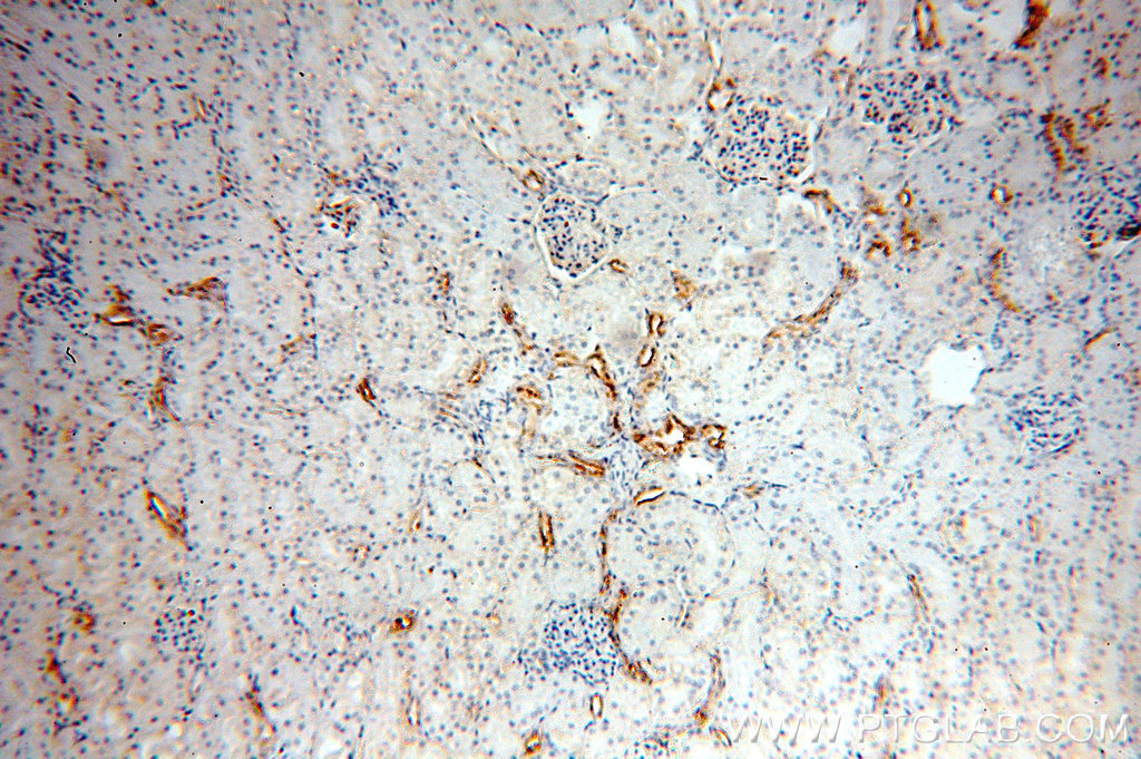 IHC staining of human kidney using 18834-1-AP