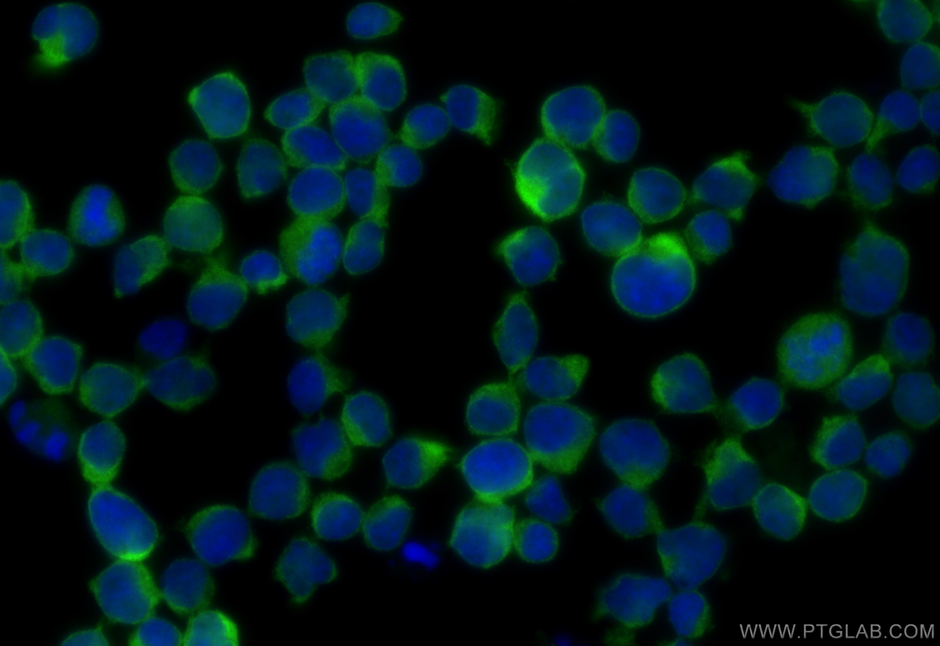 IF Staining of Jurkat using 16697-1-AP