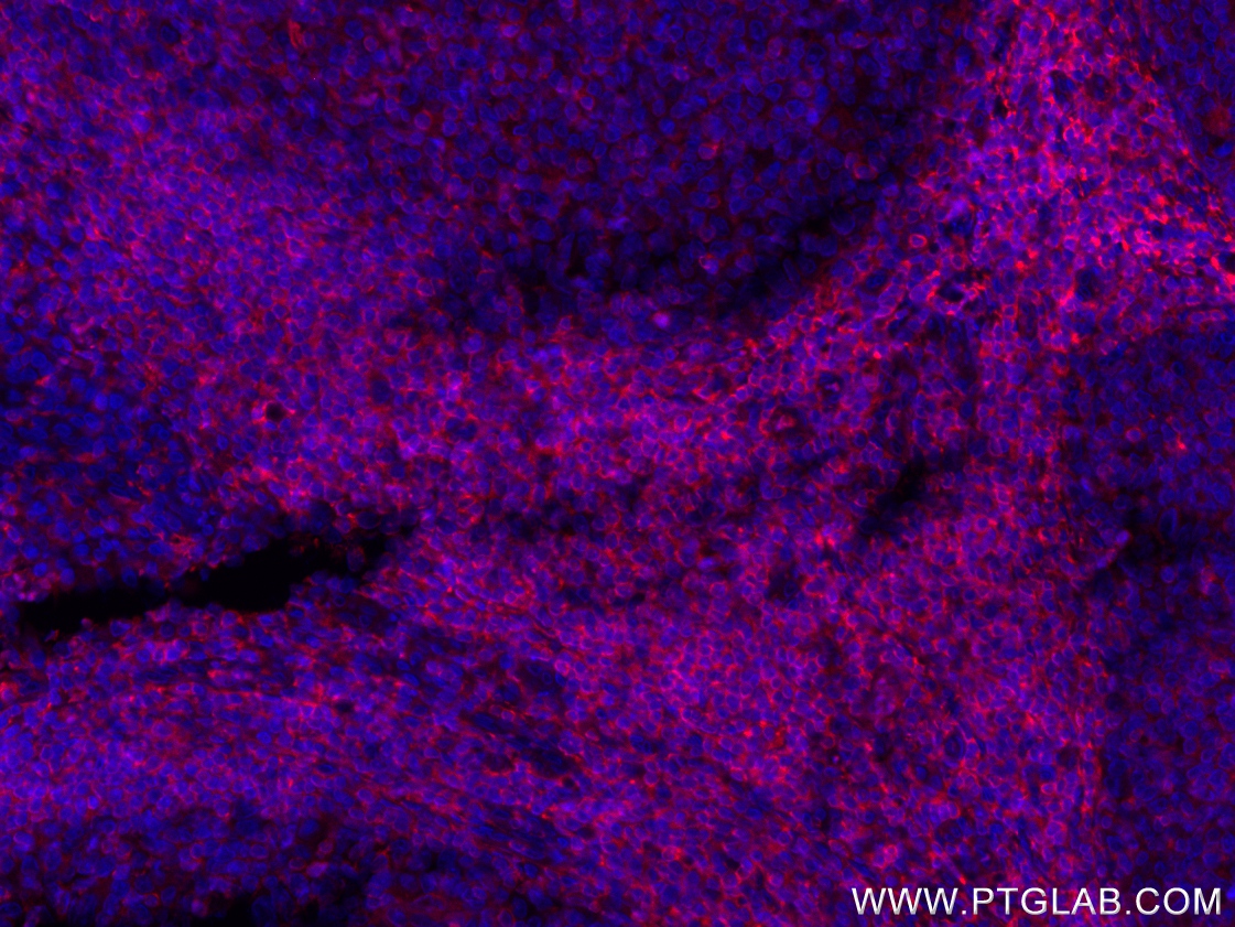 IF Staining of human tonsillitis using CL594-66054