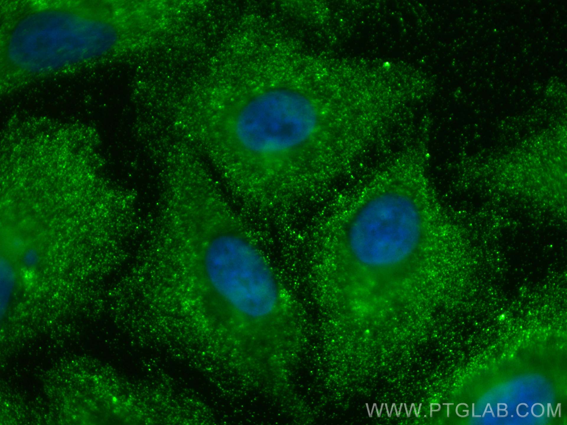 IF Staining of A549 using 11363-1-AP