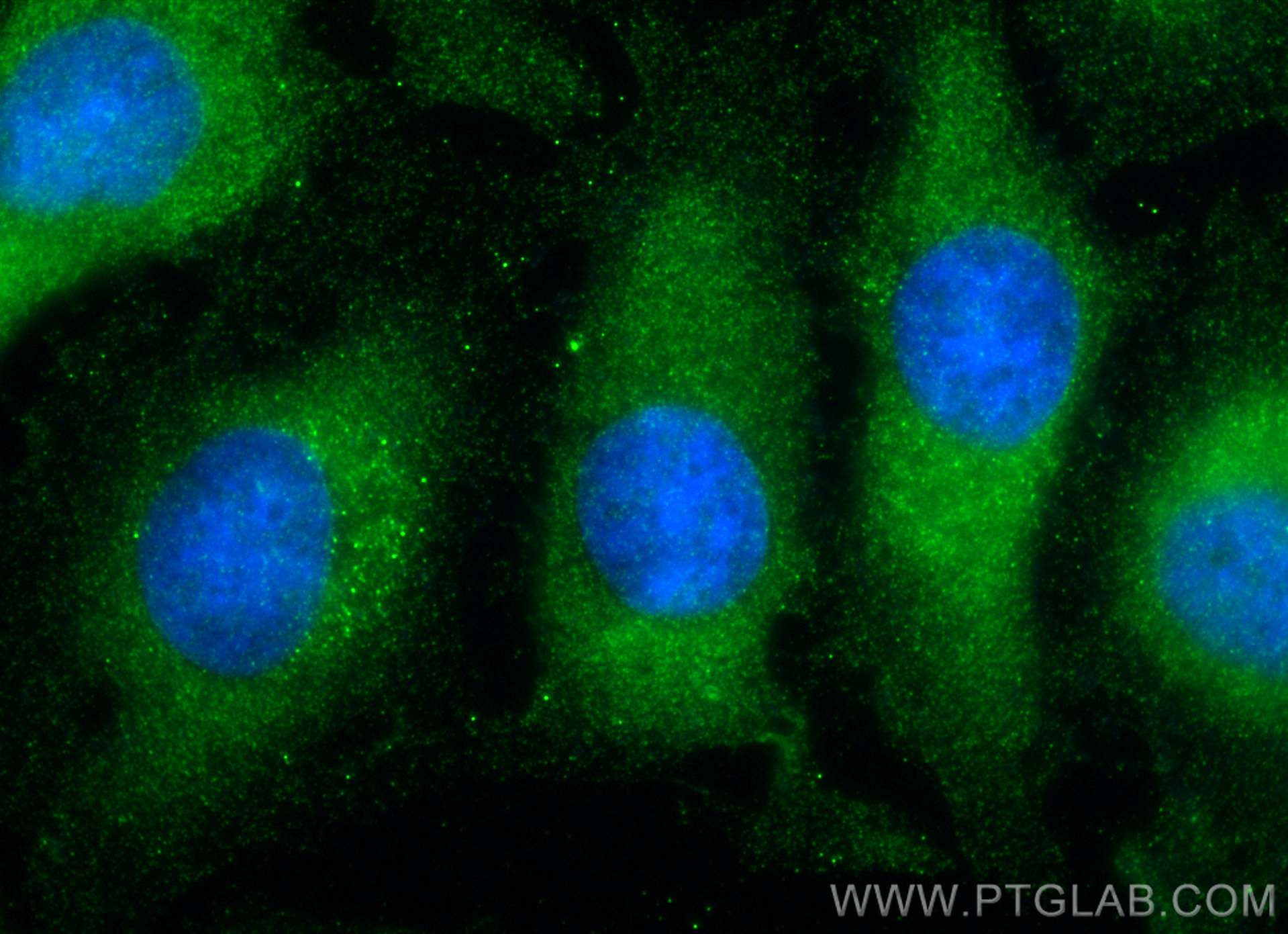 IF Staining of HeLa using 67975-1-Ig (same clone as 67975-1-PBS)