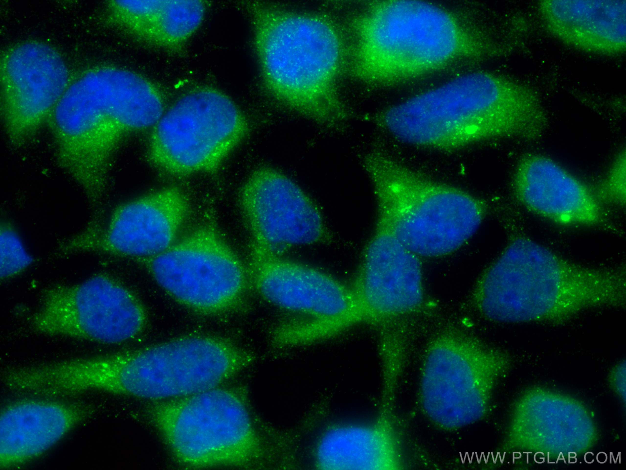 IF Staining of HEK-293 using 11243-1-AP