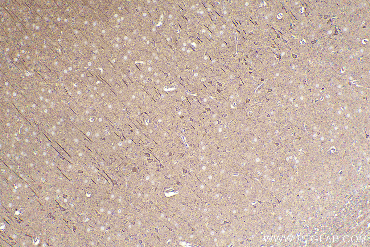 IHC staining of rat brain using 14092-1-AP