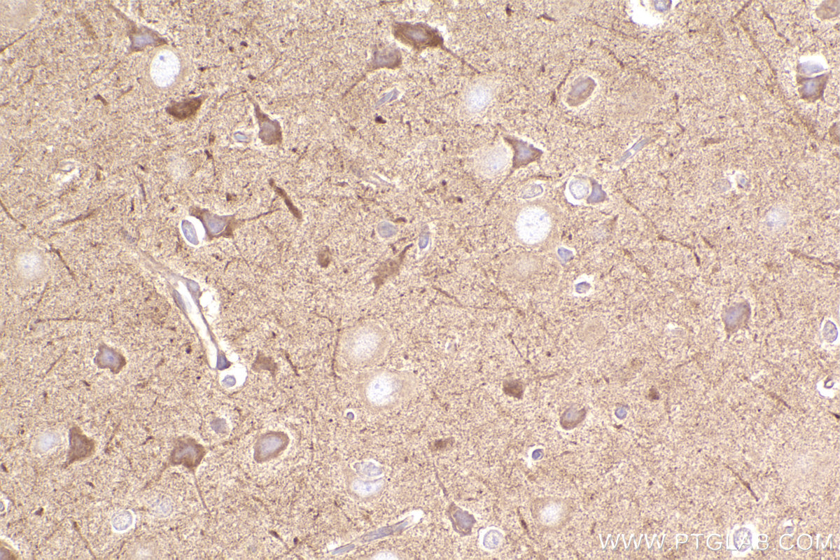 IHC staining of rat brain using 14092-1-AP