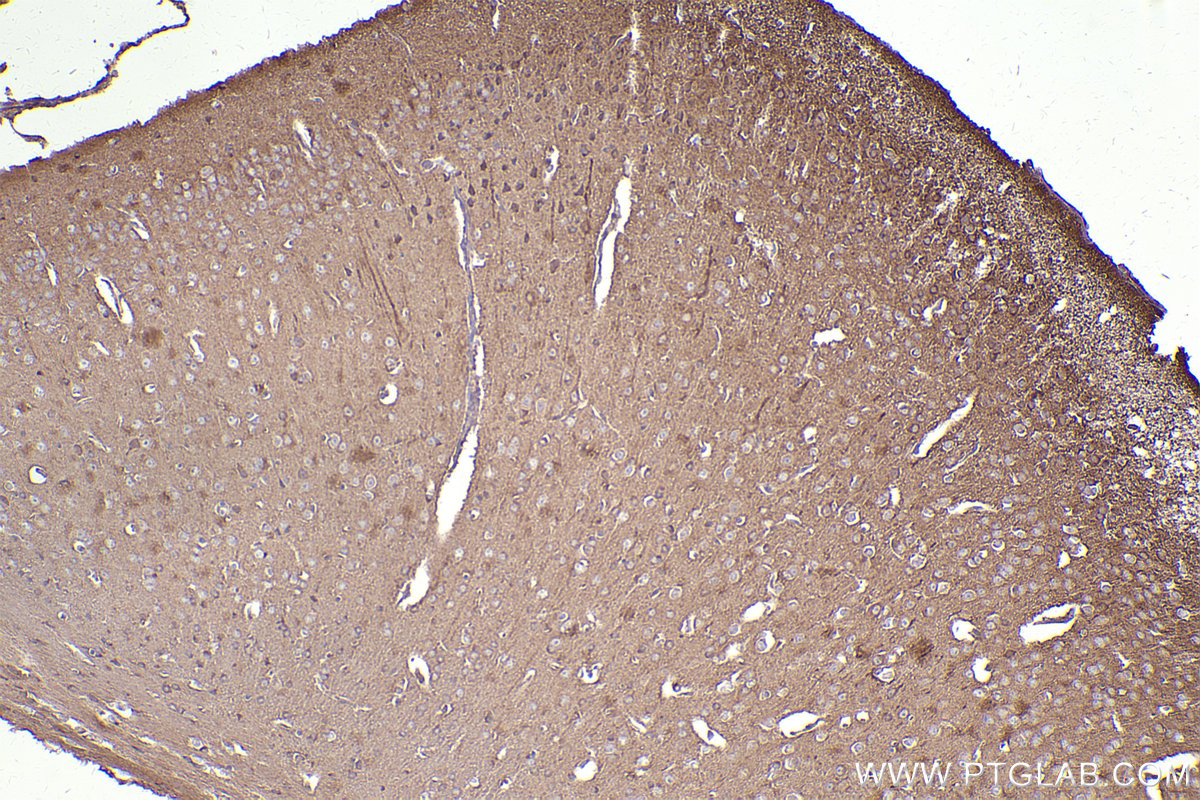 IHC staining of mouse brain using 14092-1-AP