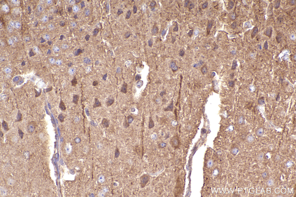 IHC staining of mouse brain using 14092-1-AP