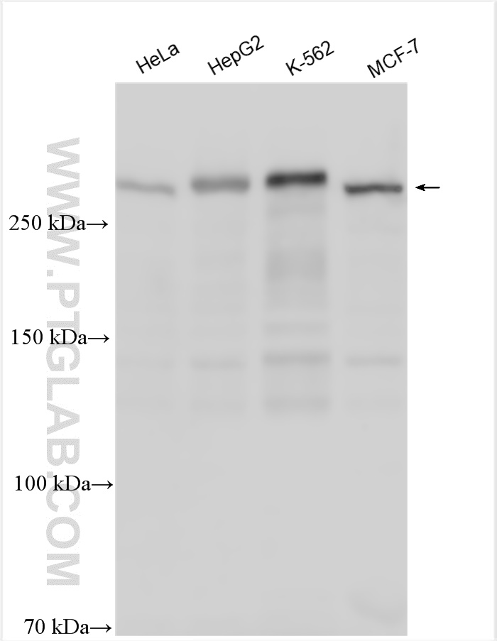 WB analysis using 30304-1-AP