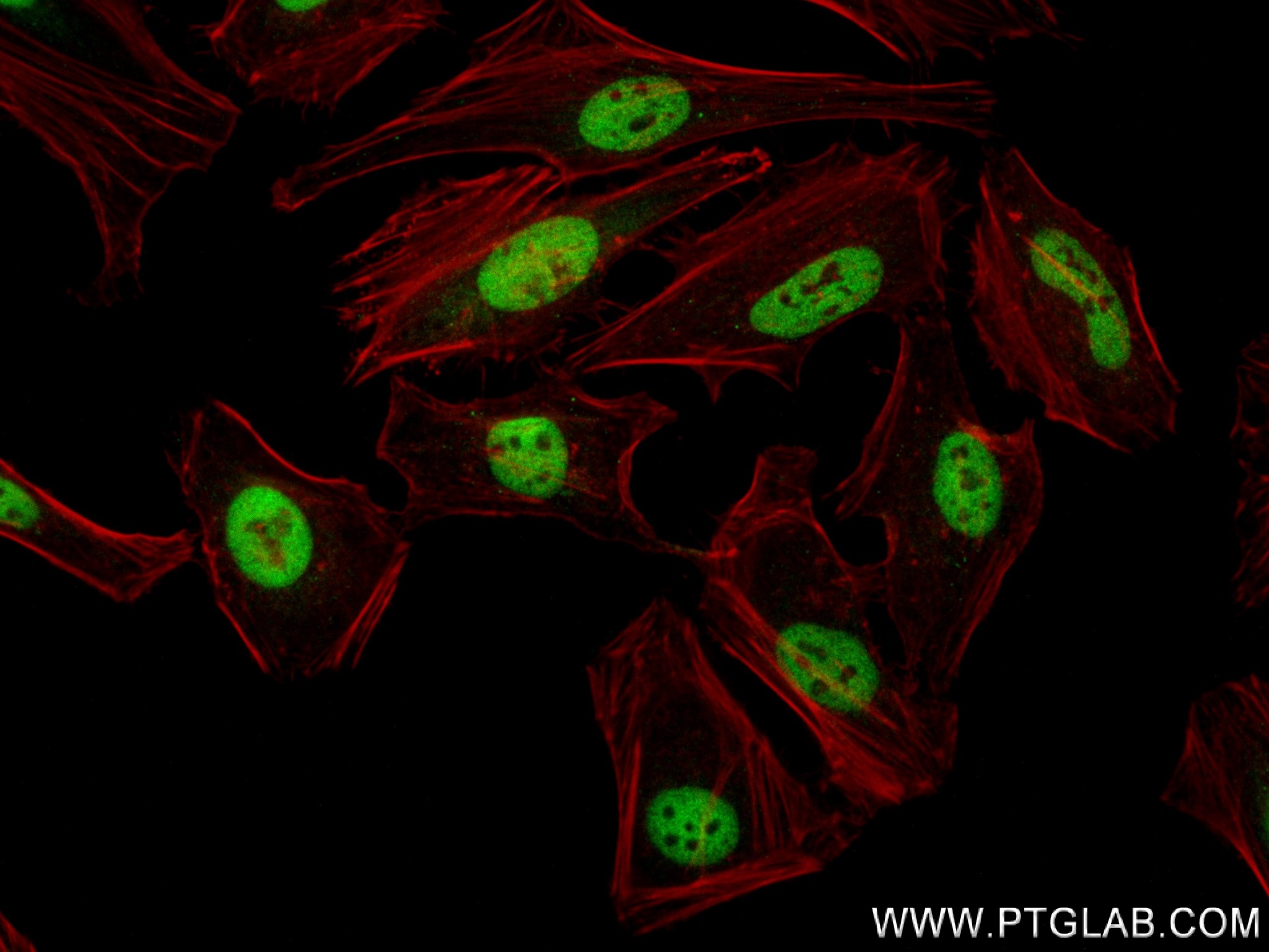 IF Staining of HeLa using 83733-3-RR