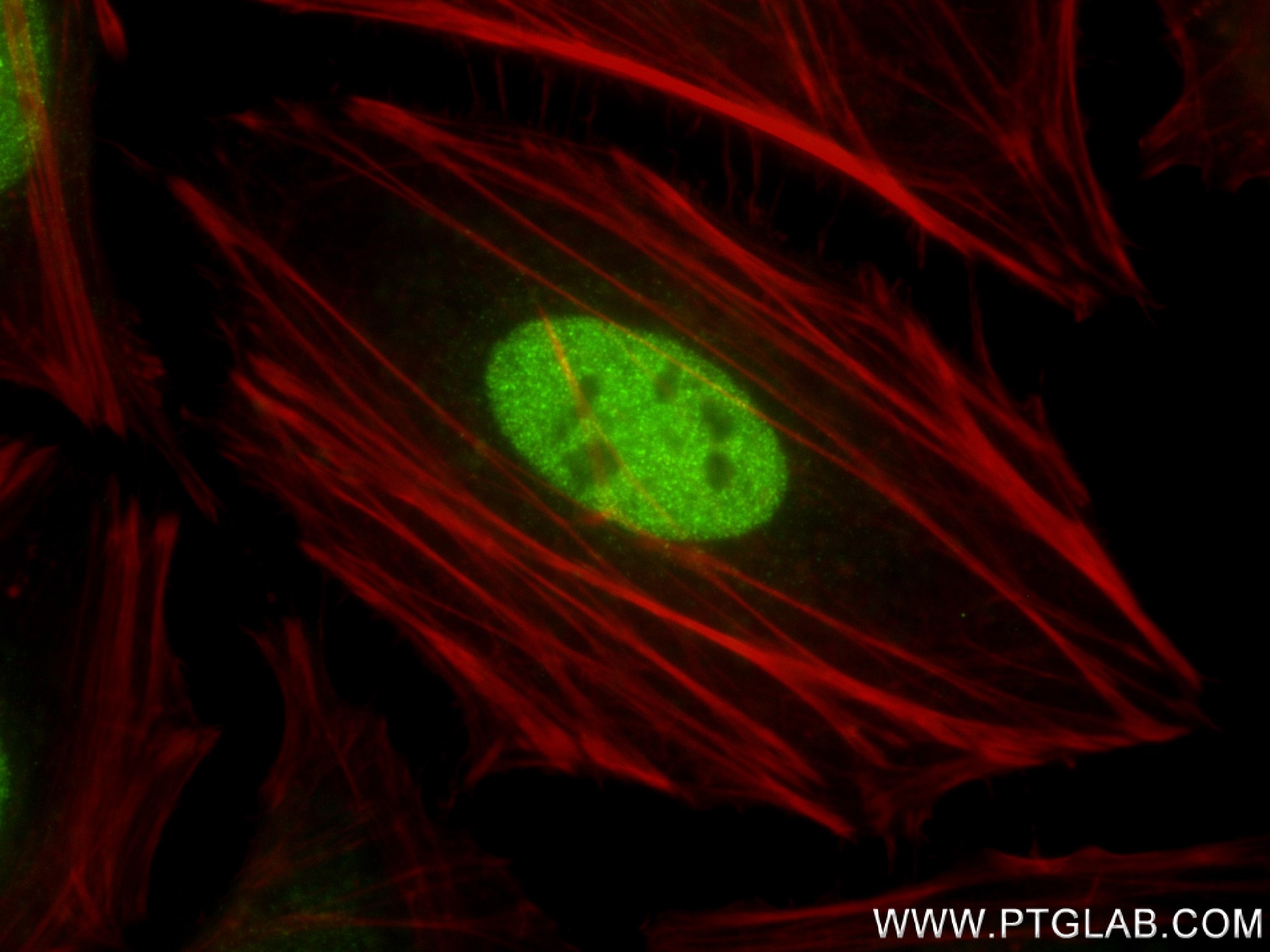 IF Staining of HeLa using 83733-3-RR (same clone as 83733-3-PBS)