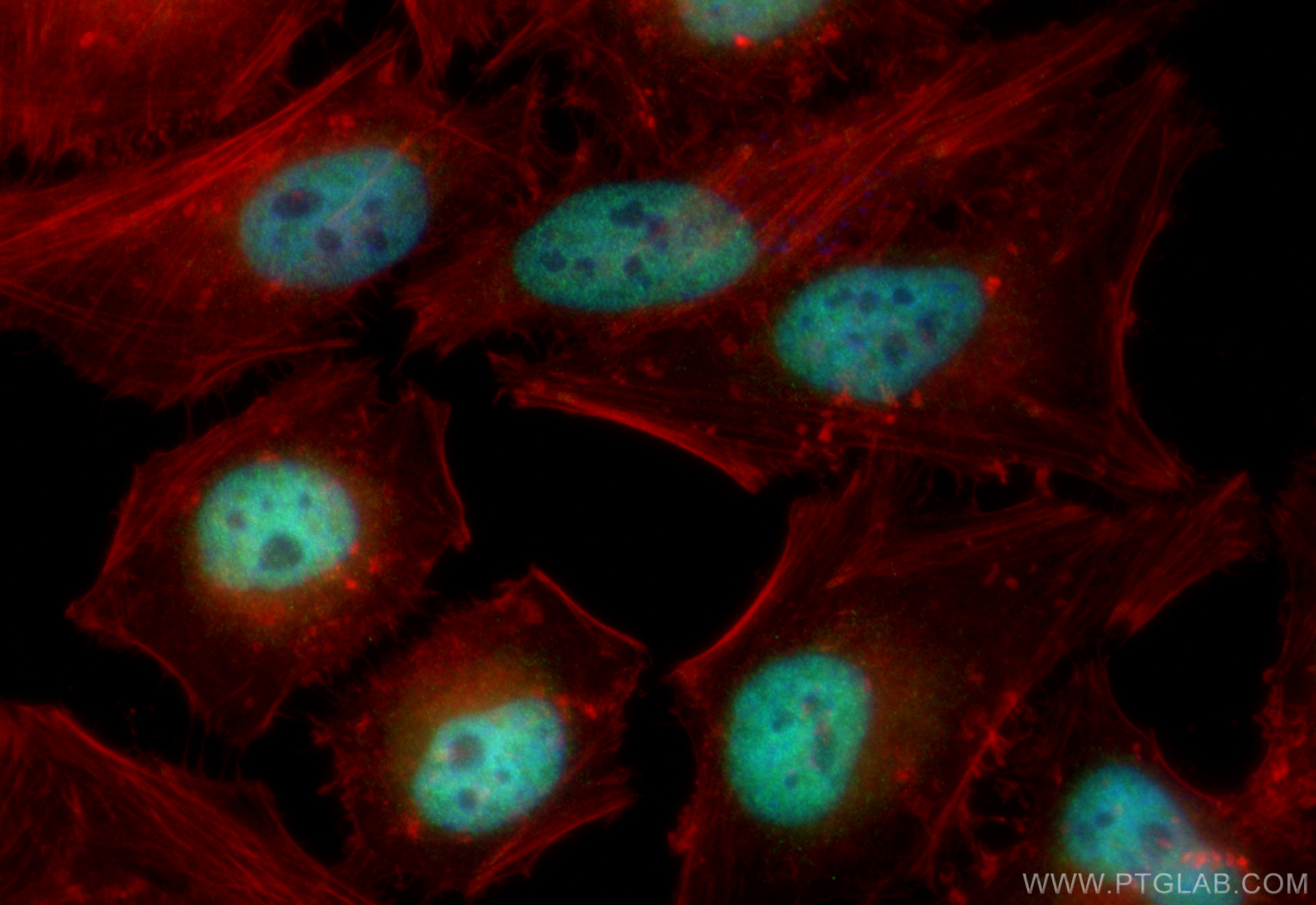 IF Staining of HeLa using CL488-83733-3