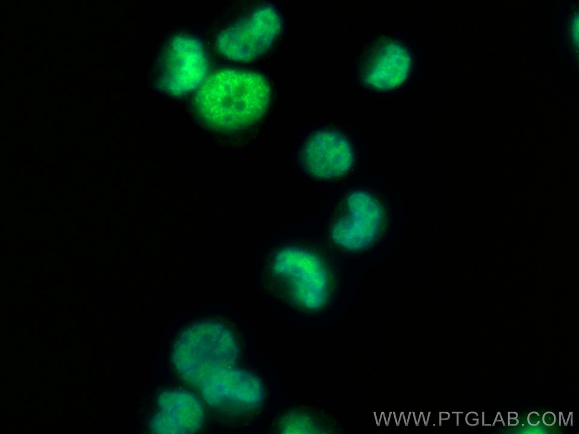 IF Staining of K-562 using 68428-1-Ig (same clone as 68428-1-PBS)