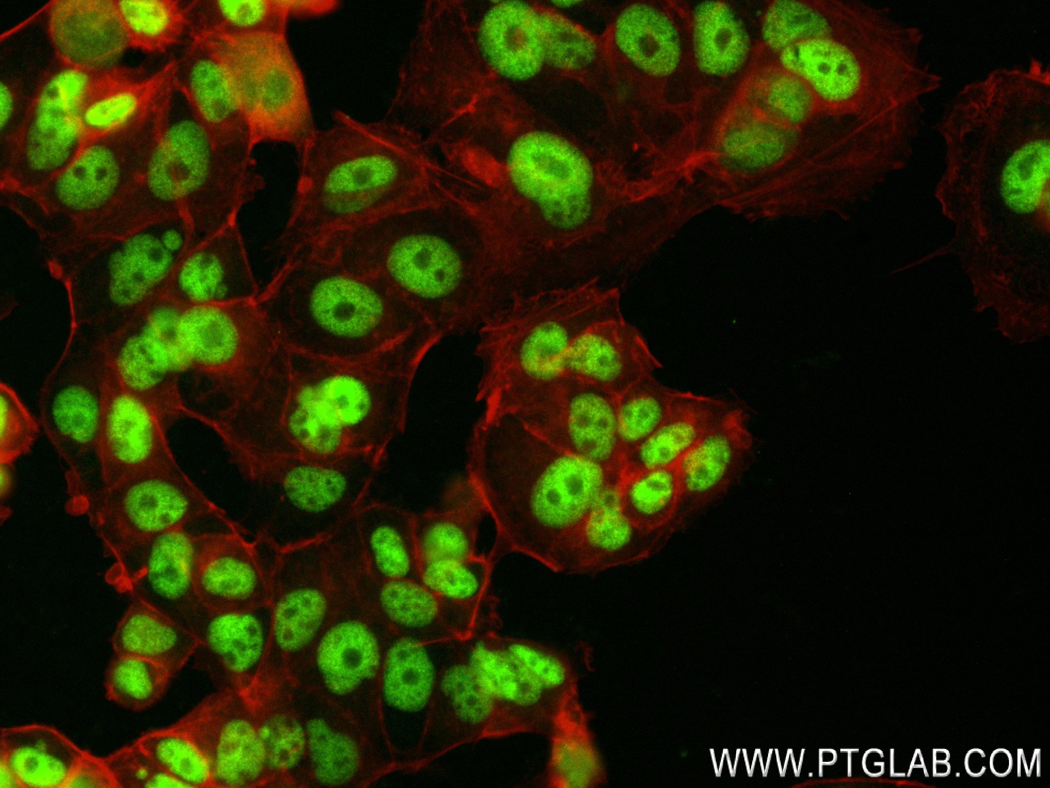 IF Staining of MCF-7 using 83489-1-RR