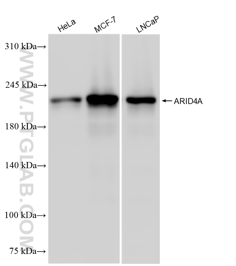 WB analysis using 83489-3-RR (same clone as 83489-3-PBS)