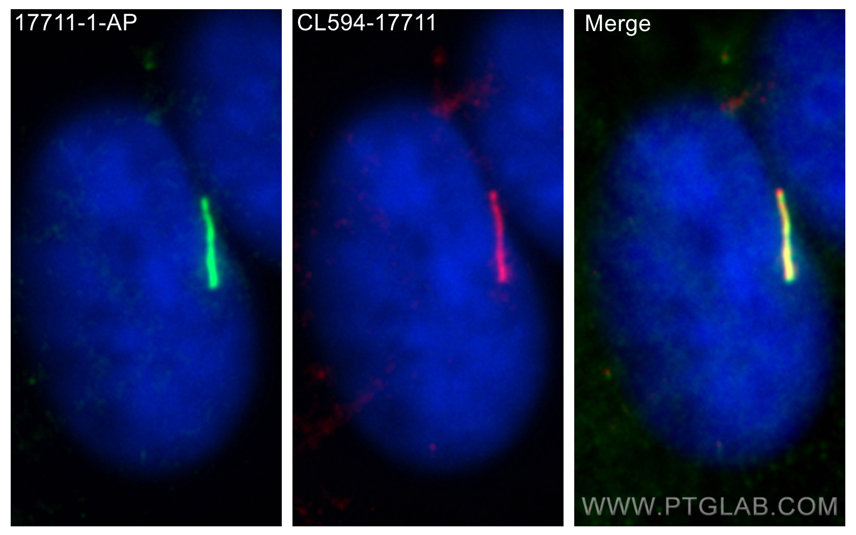 IF Staining of hTERT-RPE1 using 17711-1-AP