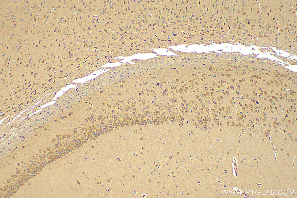 IHC staining of mouse brain using 17711-1-AP