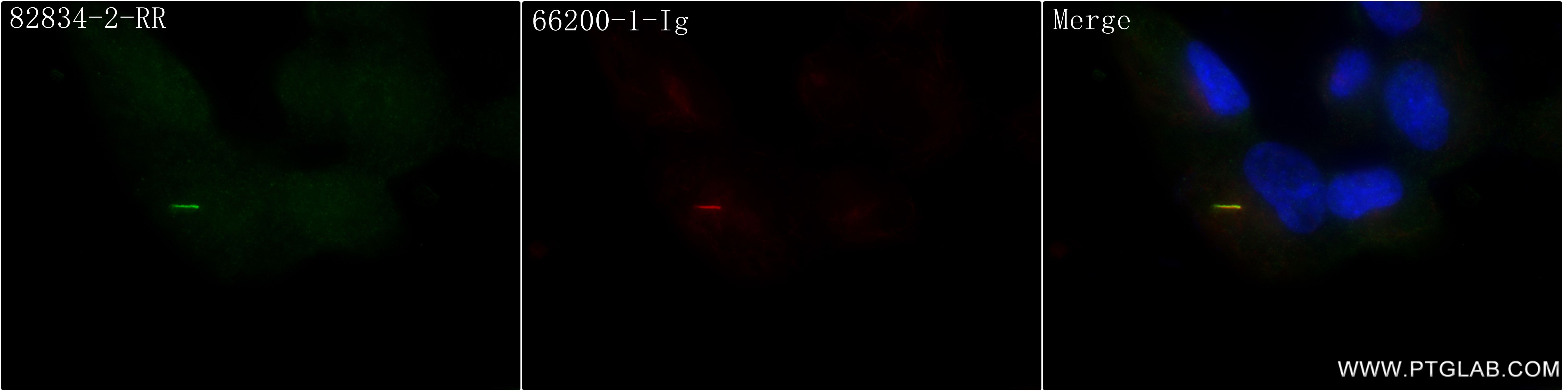 IF Staining of hTERT-RPE1 using 82834-2-RR (same clone as 82834-2-PBS)