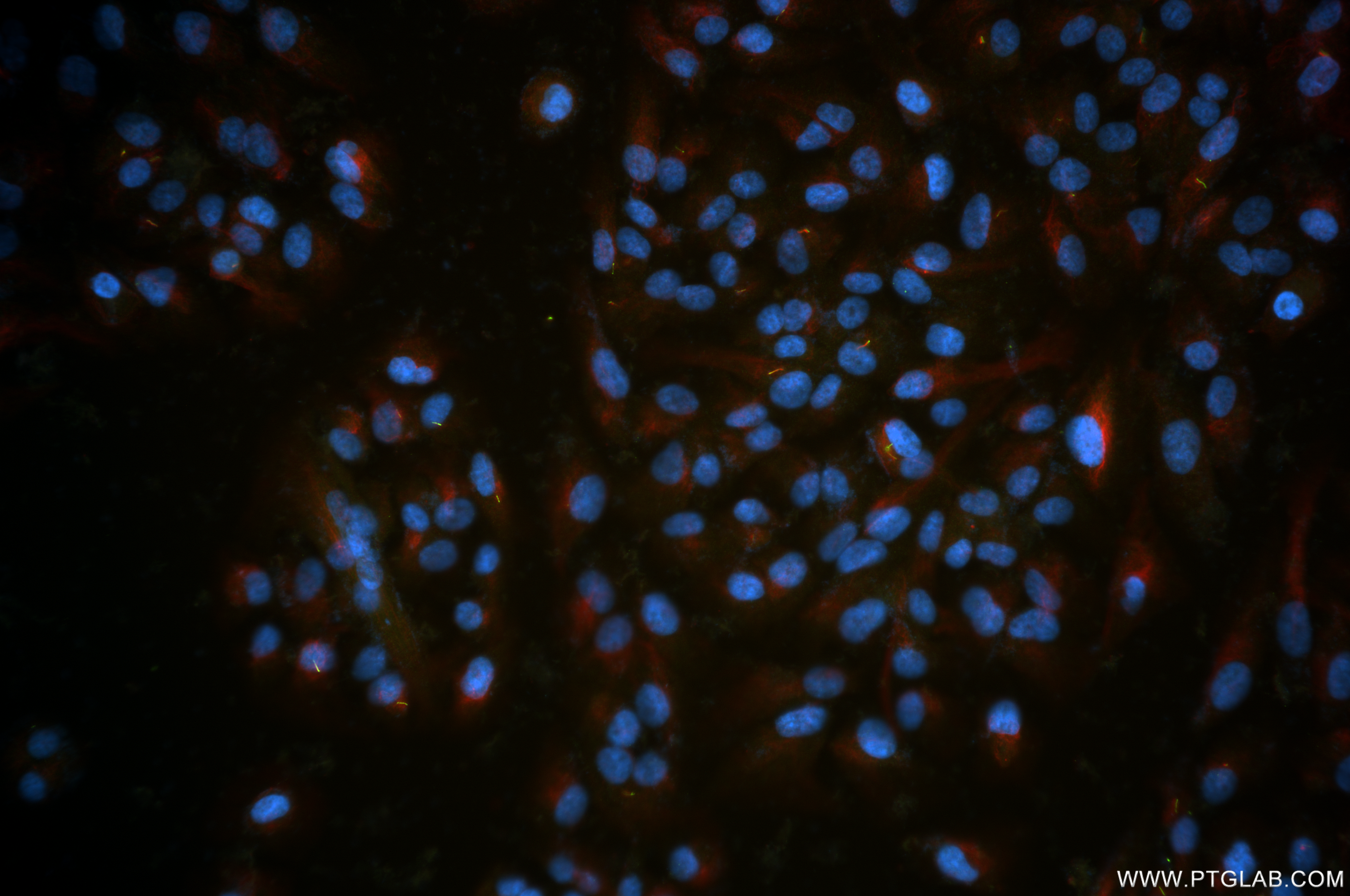 IF Staining of hTERT-RPE1 using 82834-2-RR