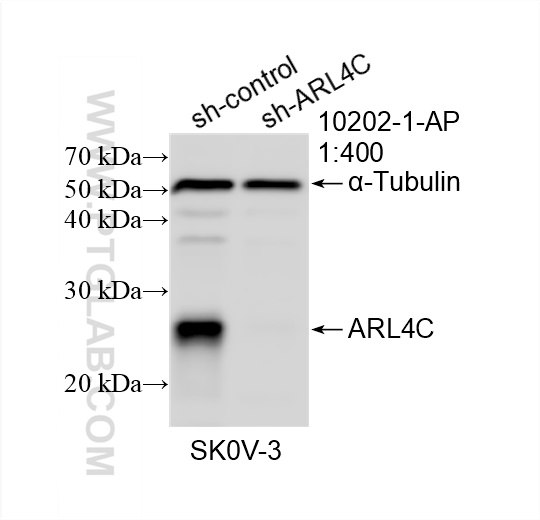 WB analysis of SKOV-3 using 10202-1-AP