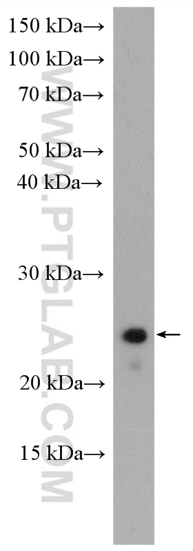 WB analysis of Jurkat using 16956-1-AP
