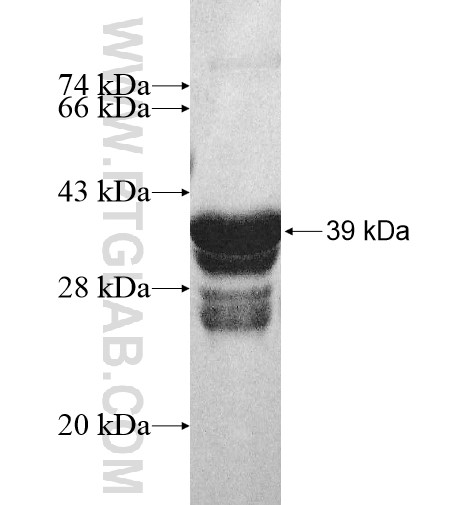 ARL6IP6 fusion protein Ag10598 SDS-PAGE