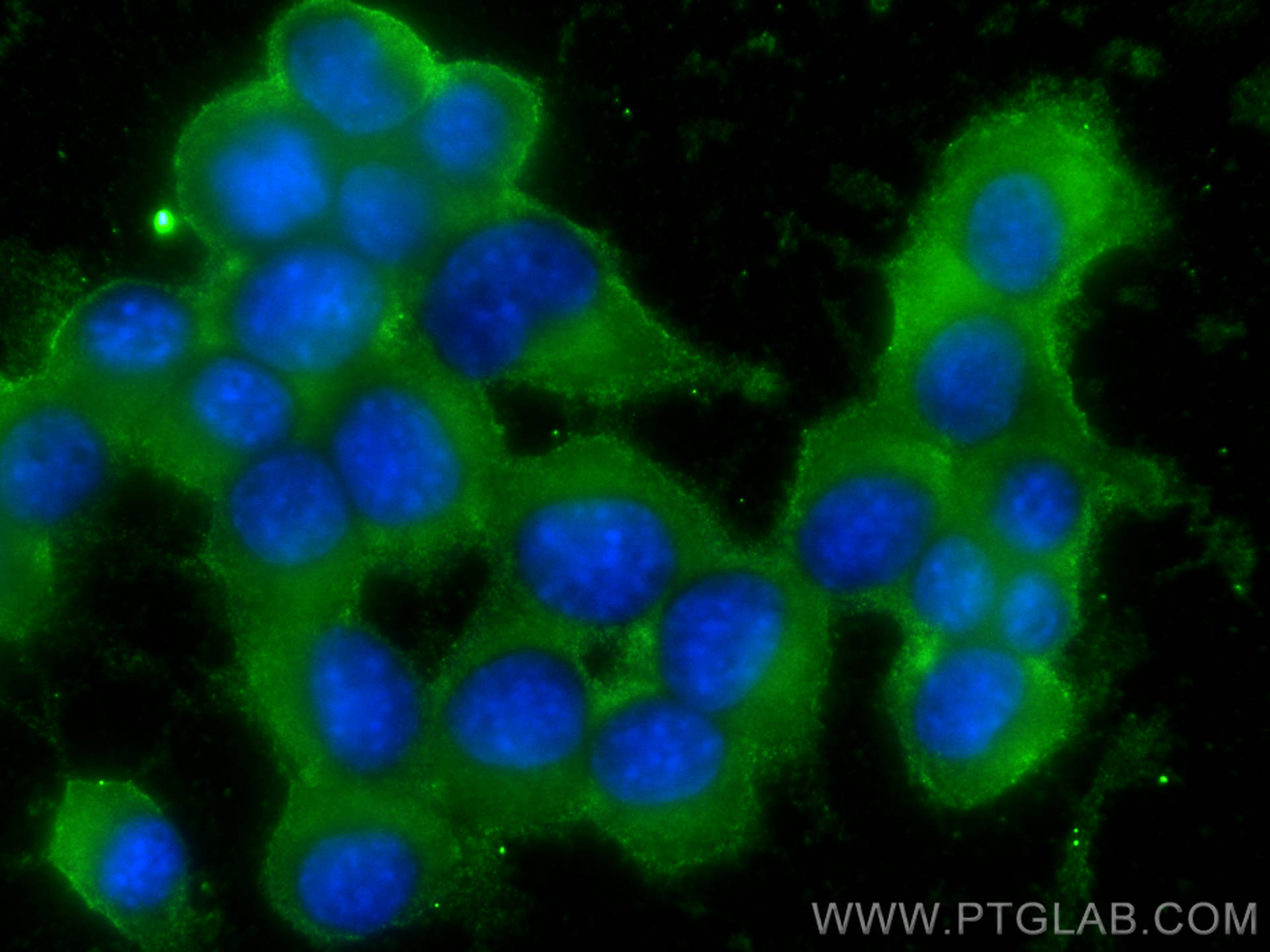 IF Staining of Neuro-2a using 68186-1-Ig