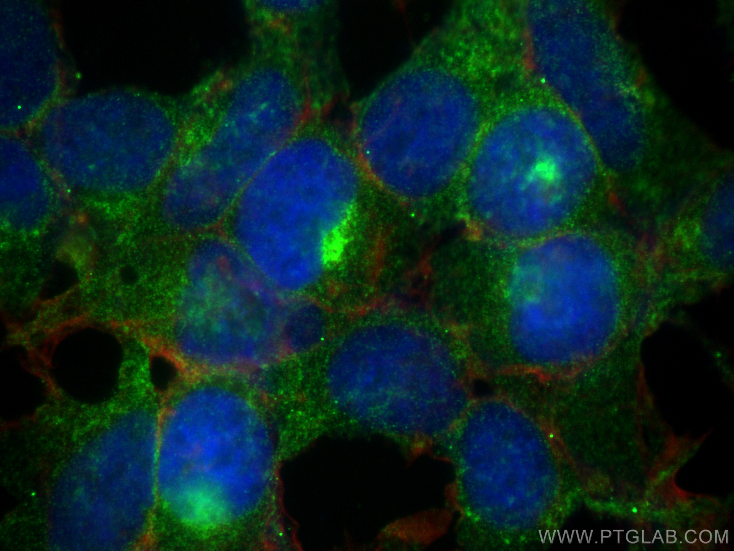 IF Staining of HEK-293 using 68186-1-Ig