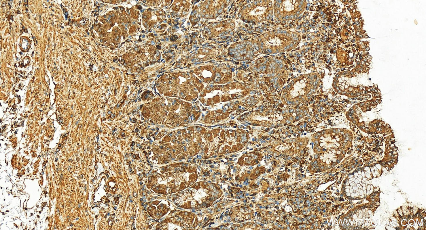 IHC staining of human stomach using 17060-1-AP