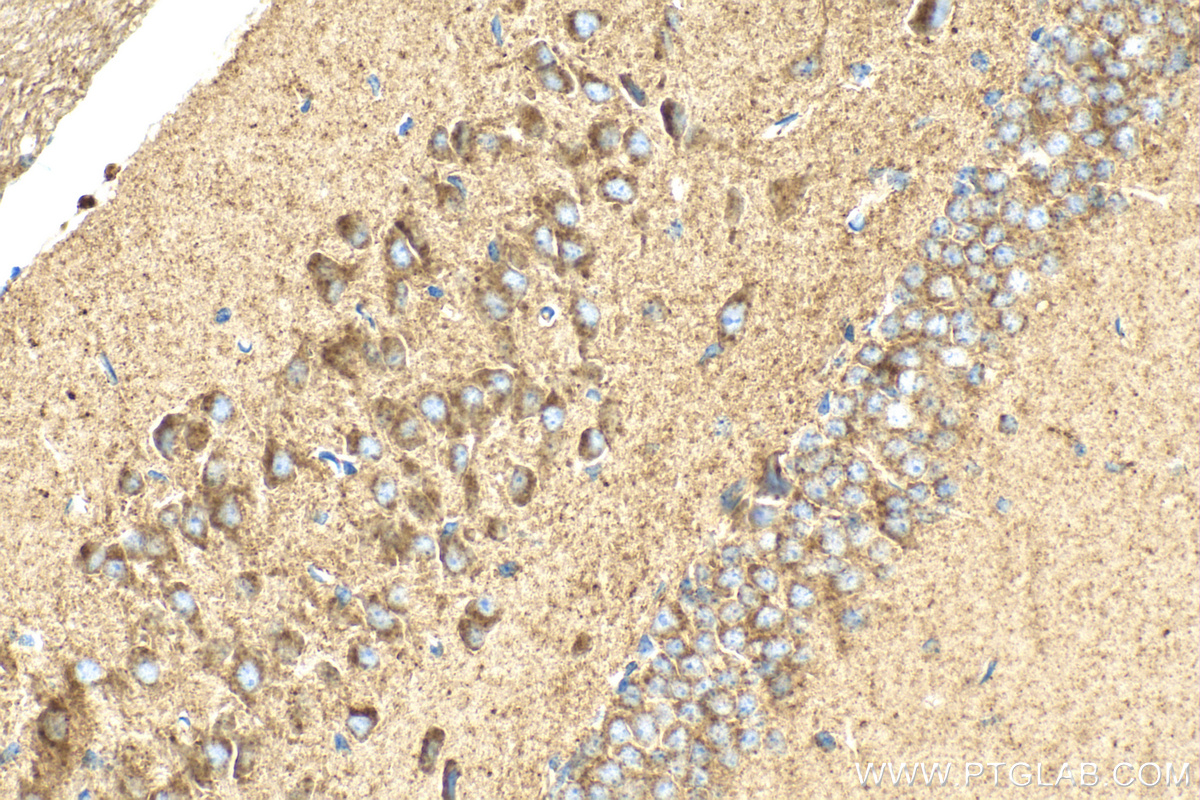 IHC staining of mouse brain using 13049-1-AP