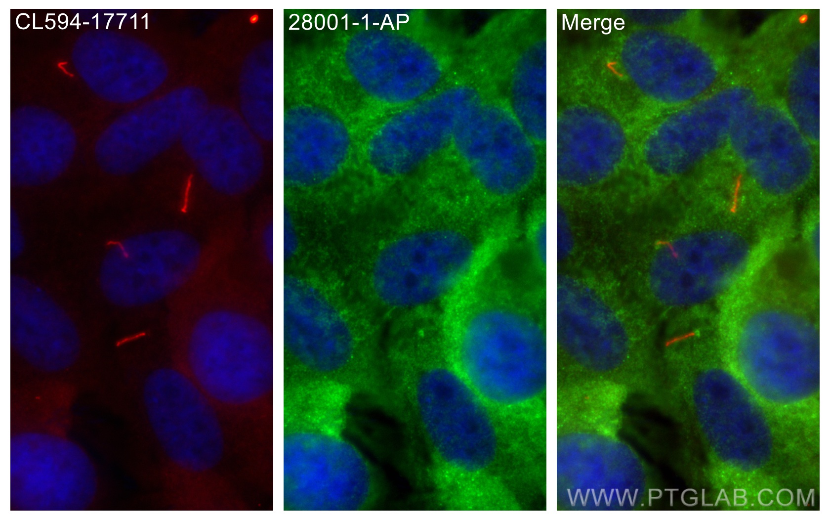 IF Staining of hTERT-RPE1 using 28001-1-AP