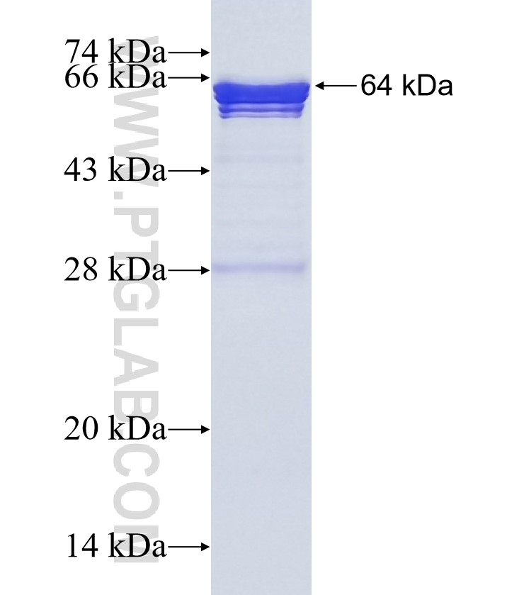 ARMC9 fusion protein Ag27511 SDS-PAGE