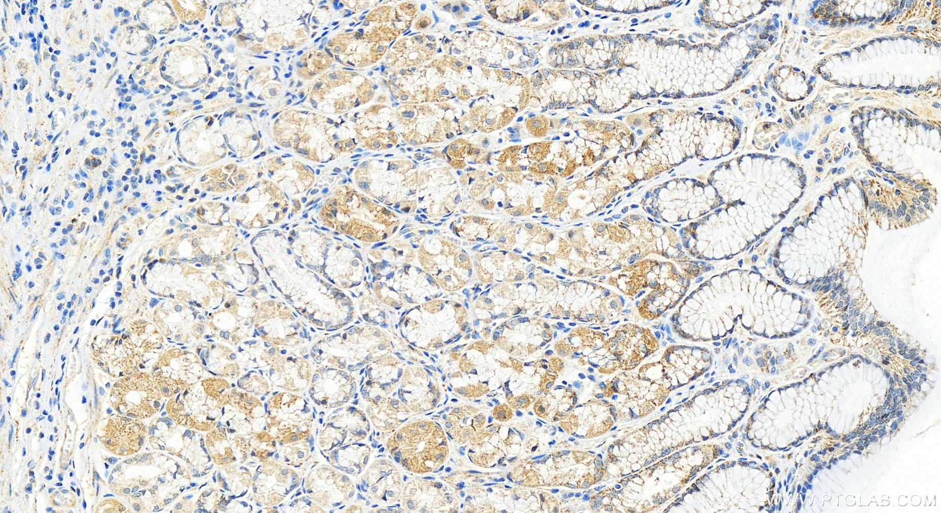 IHC staining of human stomach using 20193-1-AP