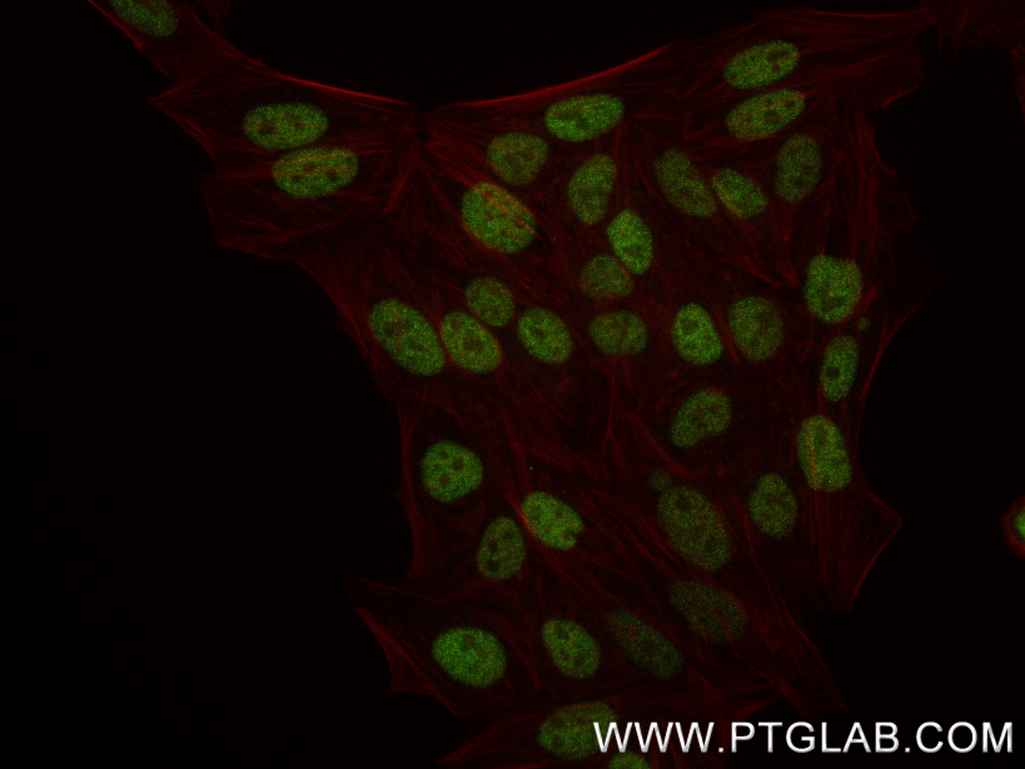 IF Staining of HepG2 using 84650-4-RR (same clone as 84650-4-PBS)