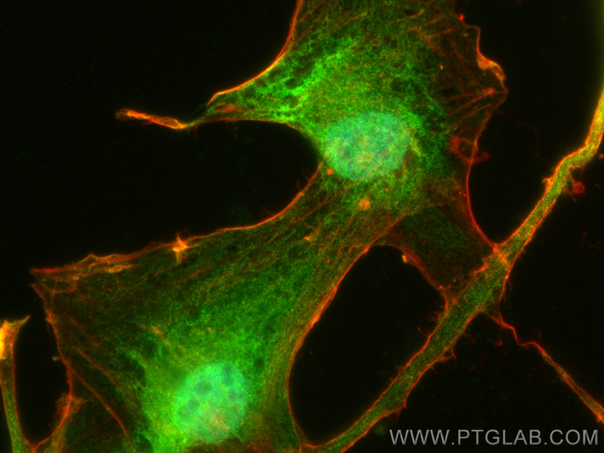 IF Staining of U-87 MG using 14268-1-AP